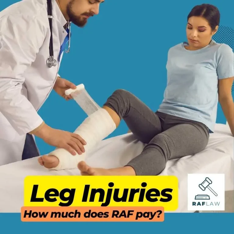 Doctor bandaging woman's leg after accident, concept of RAF compensation for leg injuries.