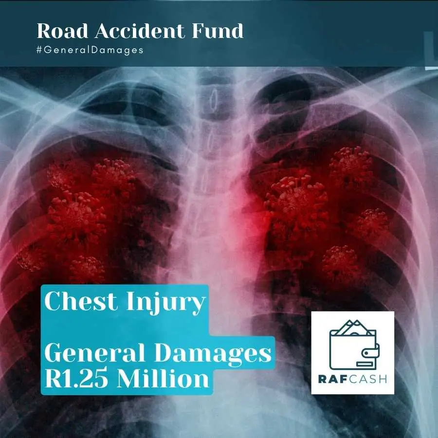 X-ray image of a chest injury with a highlighted claim amount for general damages from the Road Accident Fund