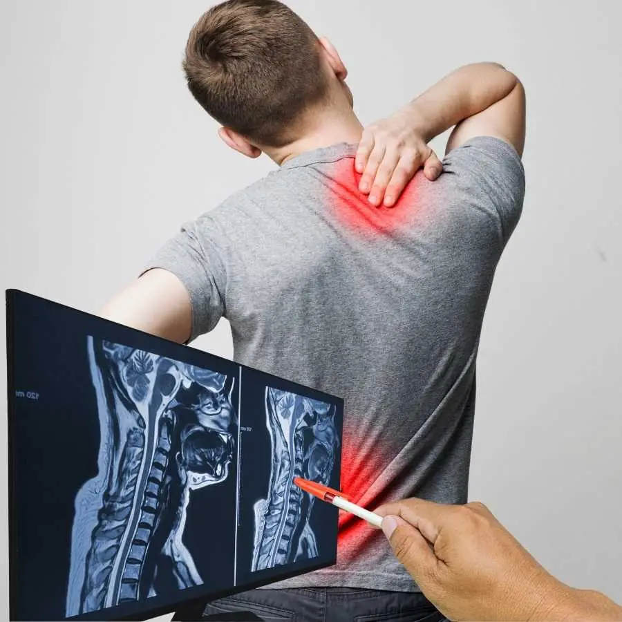 Man experiencing upper back pain while a hand points to his spinal MRI